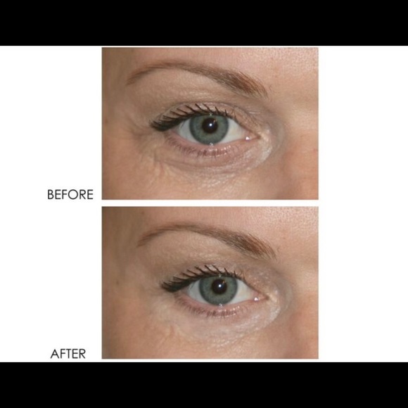 NIB DERMELECT REVITALITE PROFESSIONAL
Eyelid & Dark Circle Corrector - Picture 3 of 5